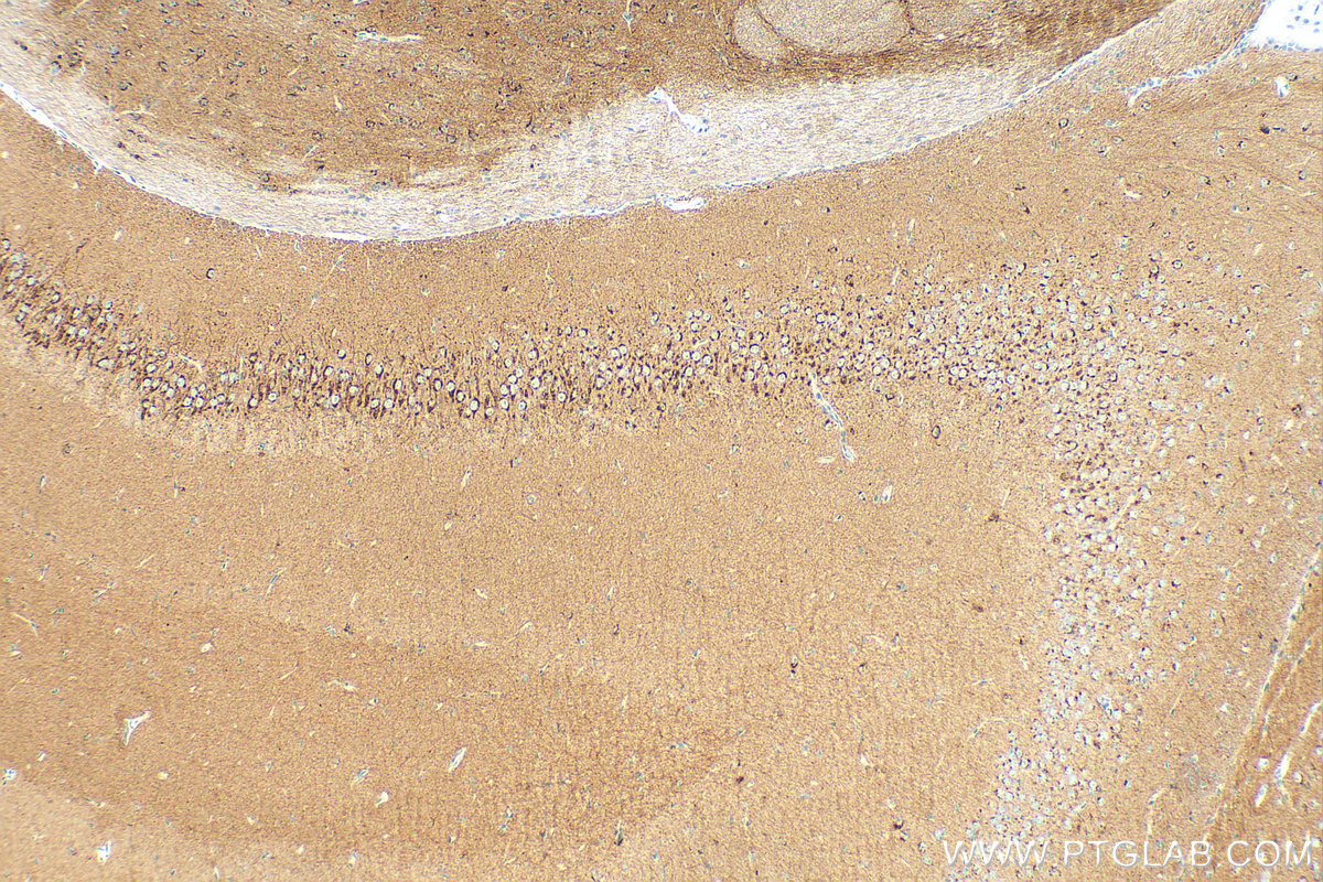 IHC staining of mouse brain using 82925-1-RR (same clone as 82925-1-PBS)