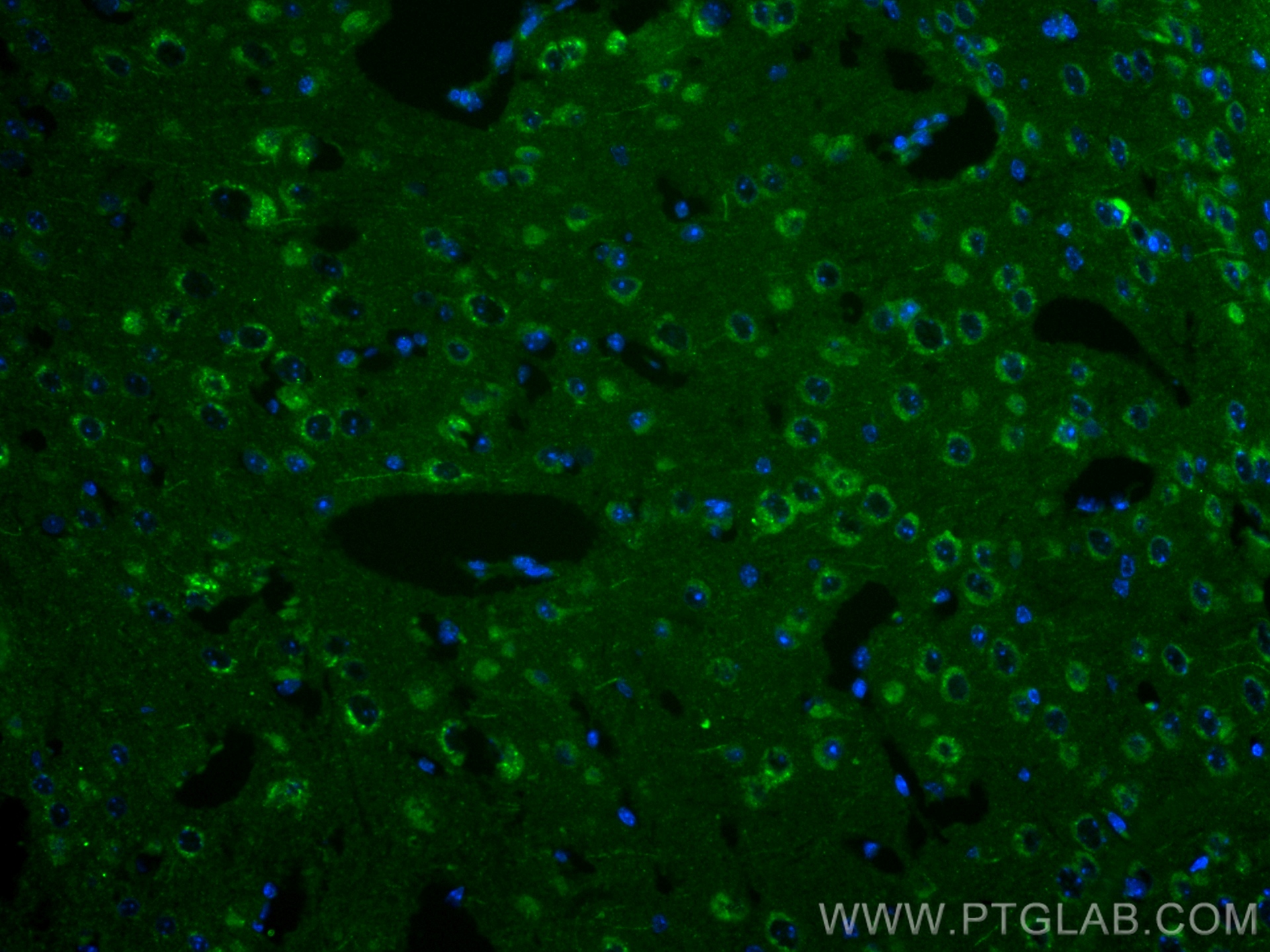 IF Staining of mouse brain using 82925-2-RR