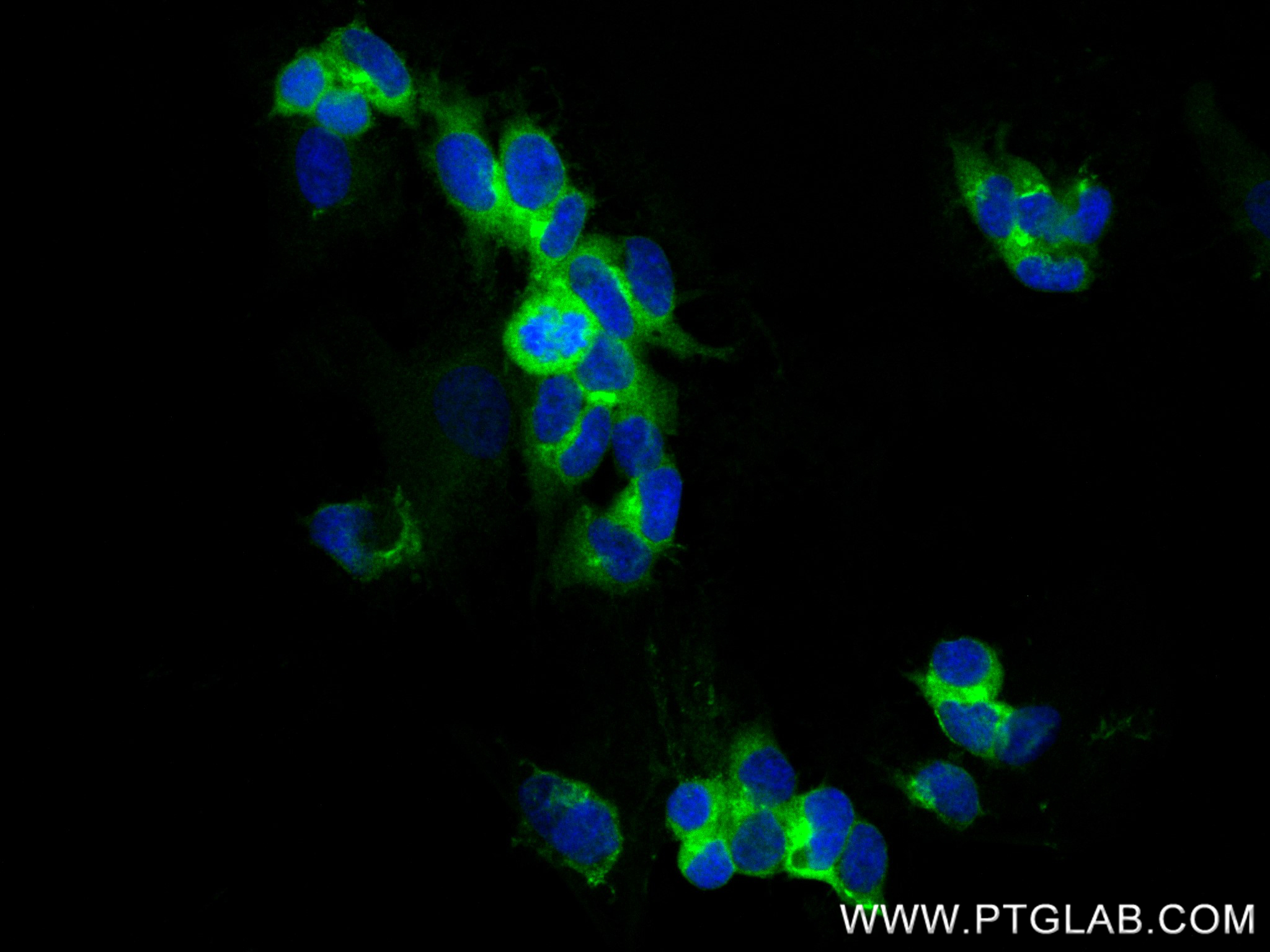 IF Staining of SH-SY5Y using 82925-3-RR