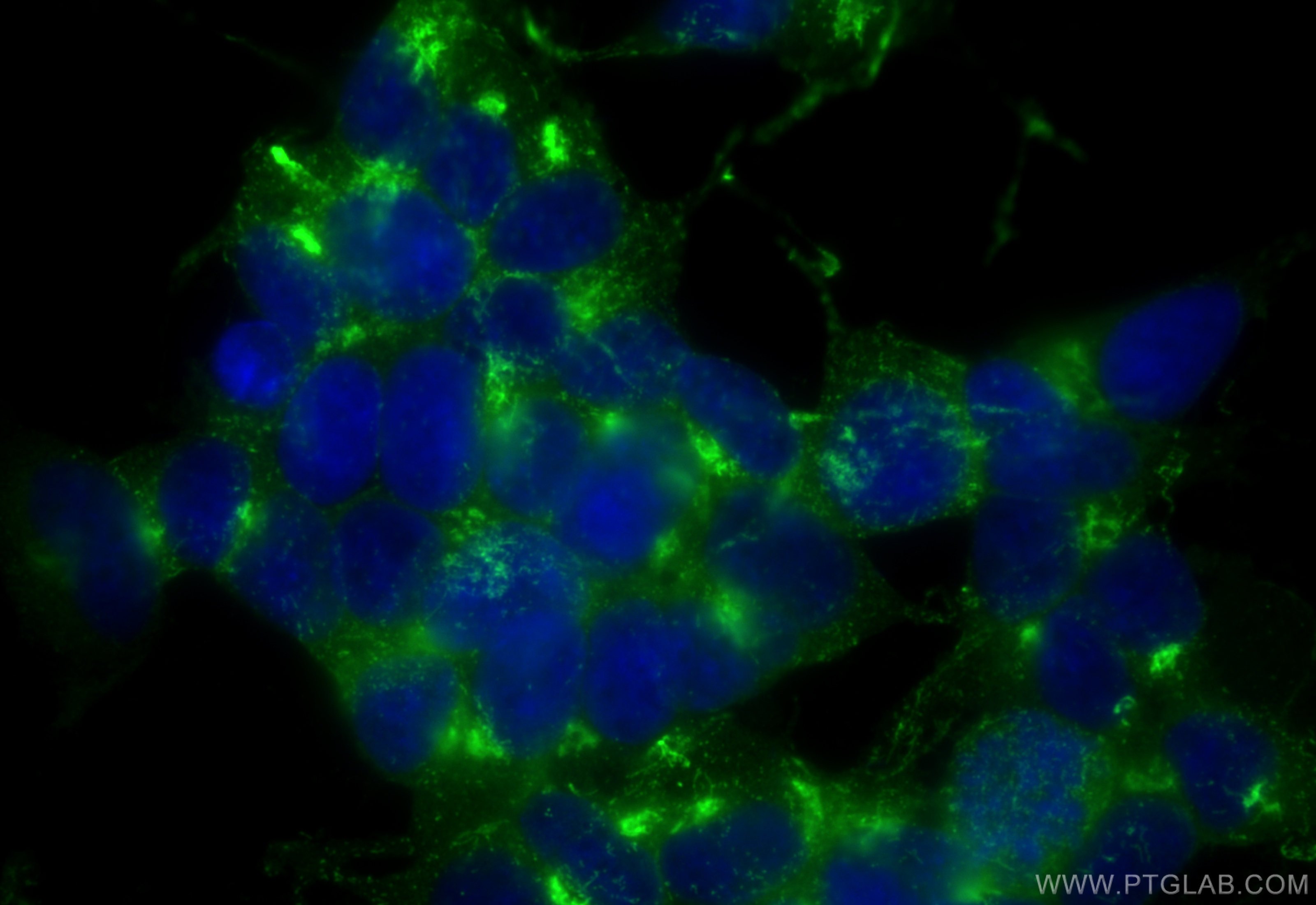 IF Staining of SH-SY5Y using CL488-10586