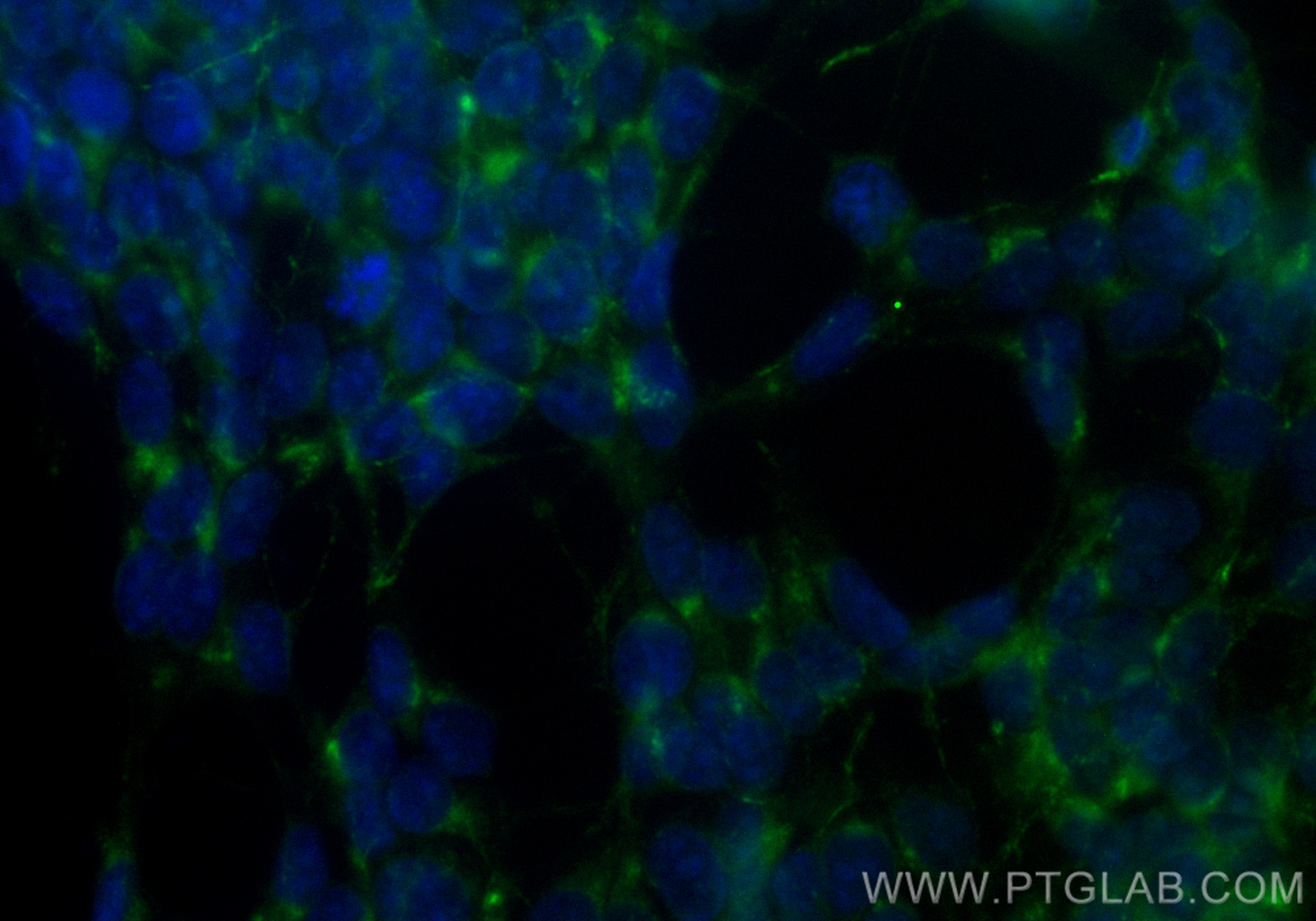 IF Staining of SH-SY5Y using CL488-82925-2