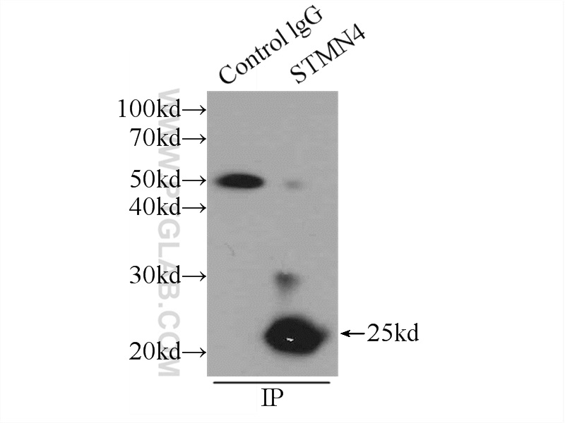 IP experiment of mouse brain using 12027-1-AP