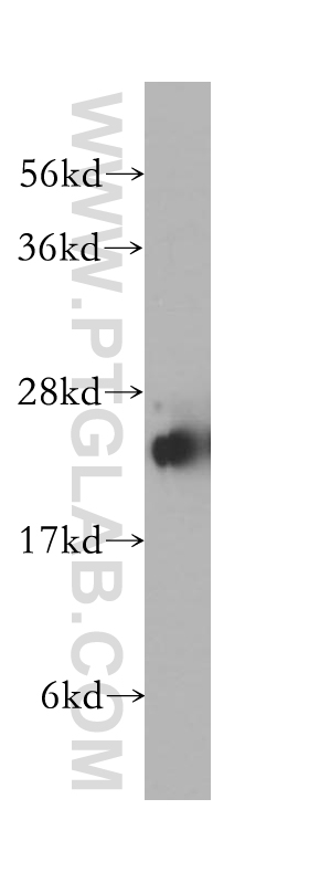 WB analysis of human brain using 12027-1-AP