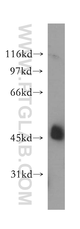 WB analysis of A375 using 12862-1-AP