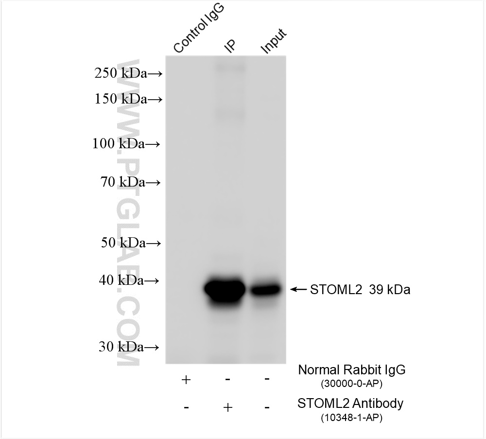 IP experiment of mouse brain using 10348-1-AP