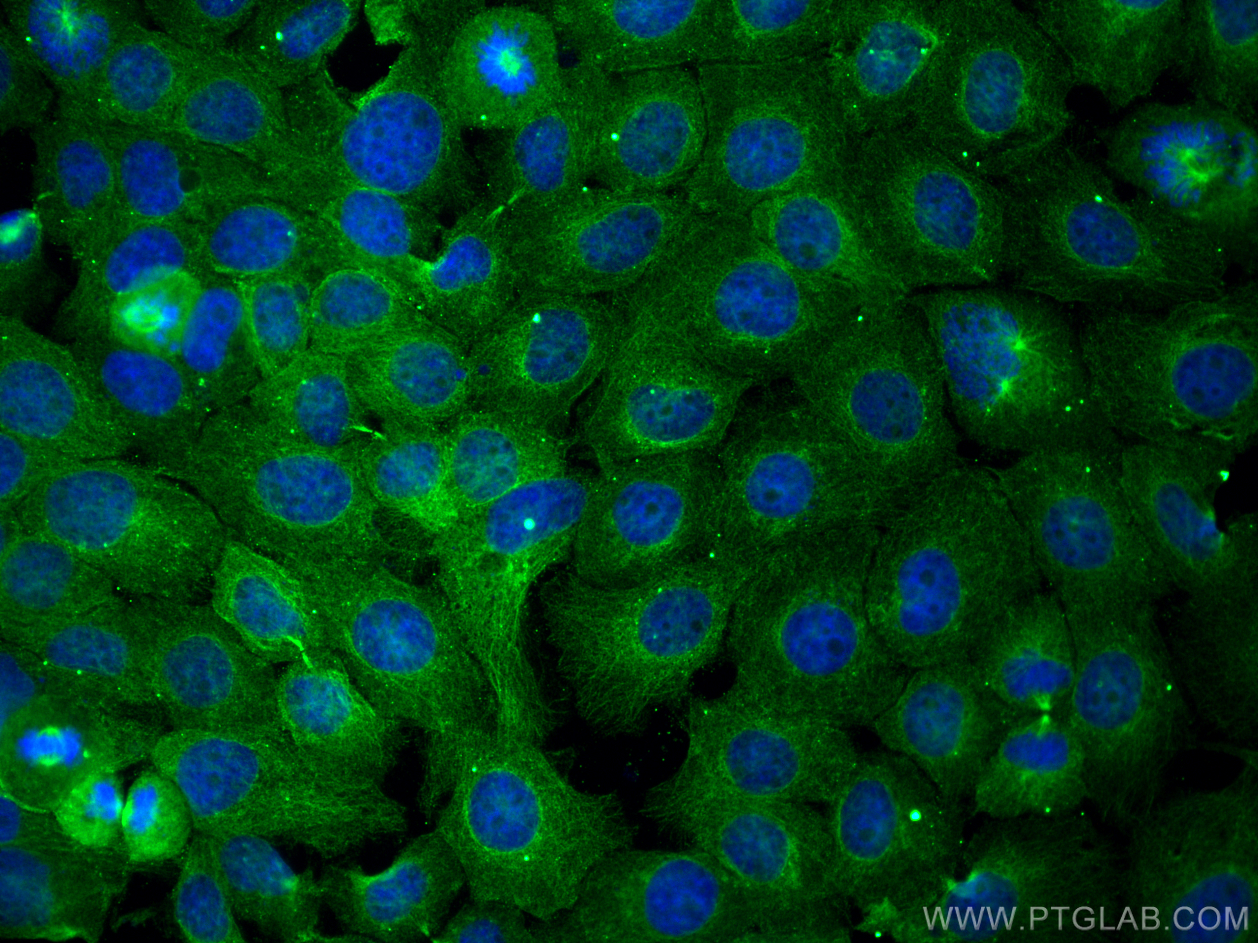 IF Staining of A431 using 60052-1-Ig