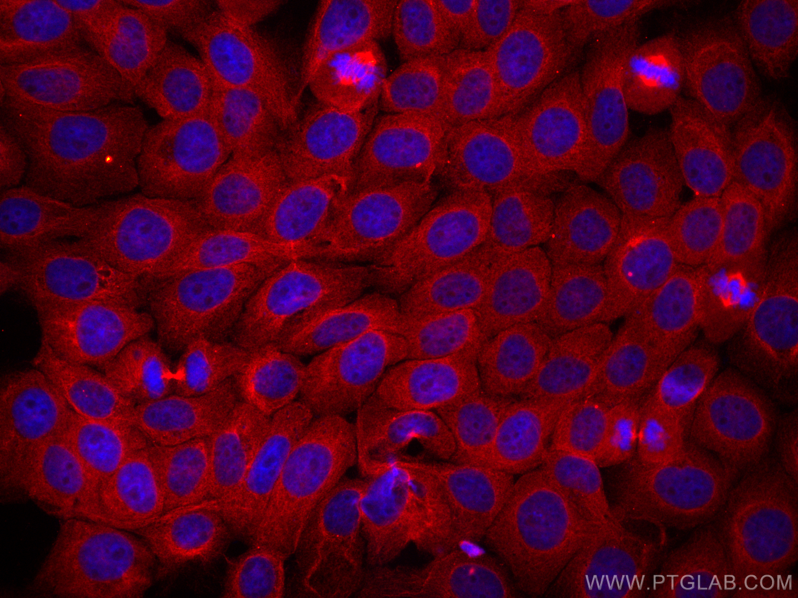 IF Staining of A431 using CL594-60052