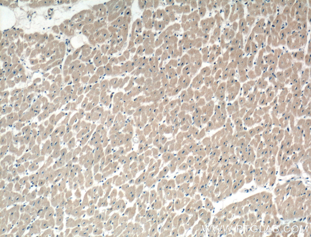 IHC staining of human heart using 10688-1-AP