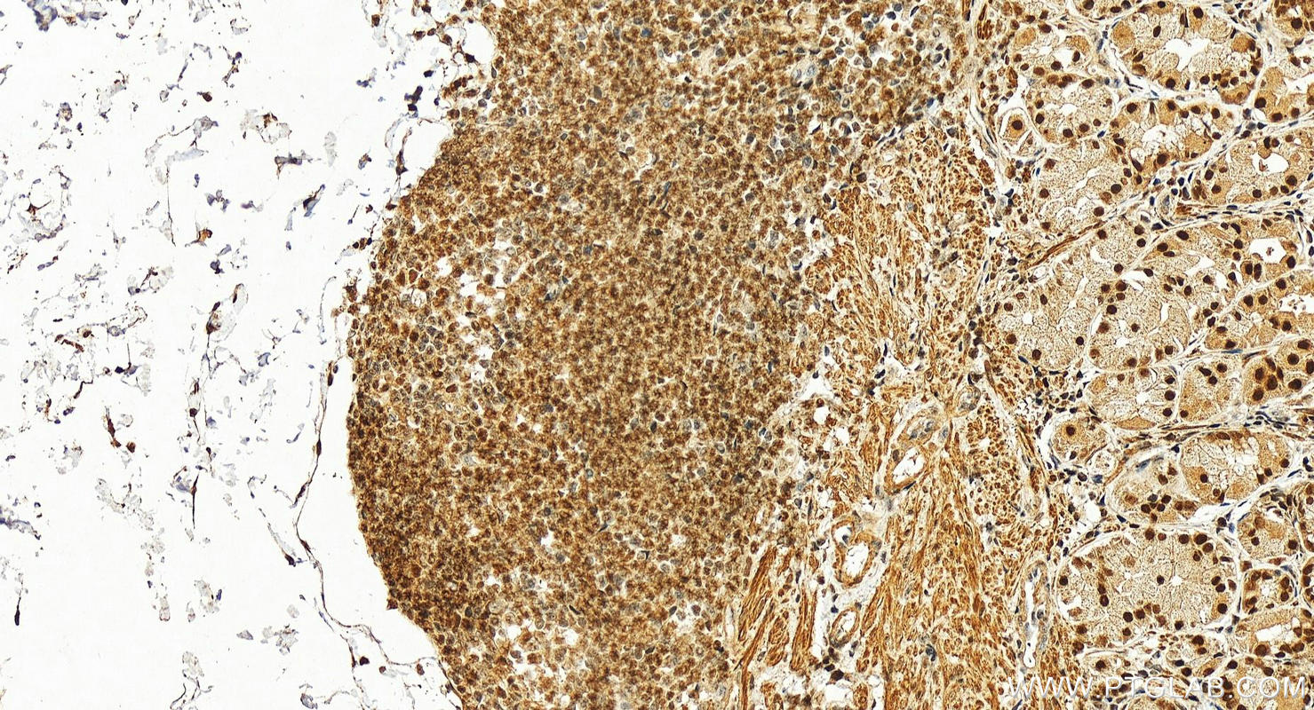 IHC staining of human stomach using 17362-1-AP