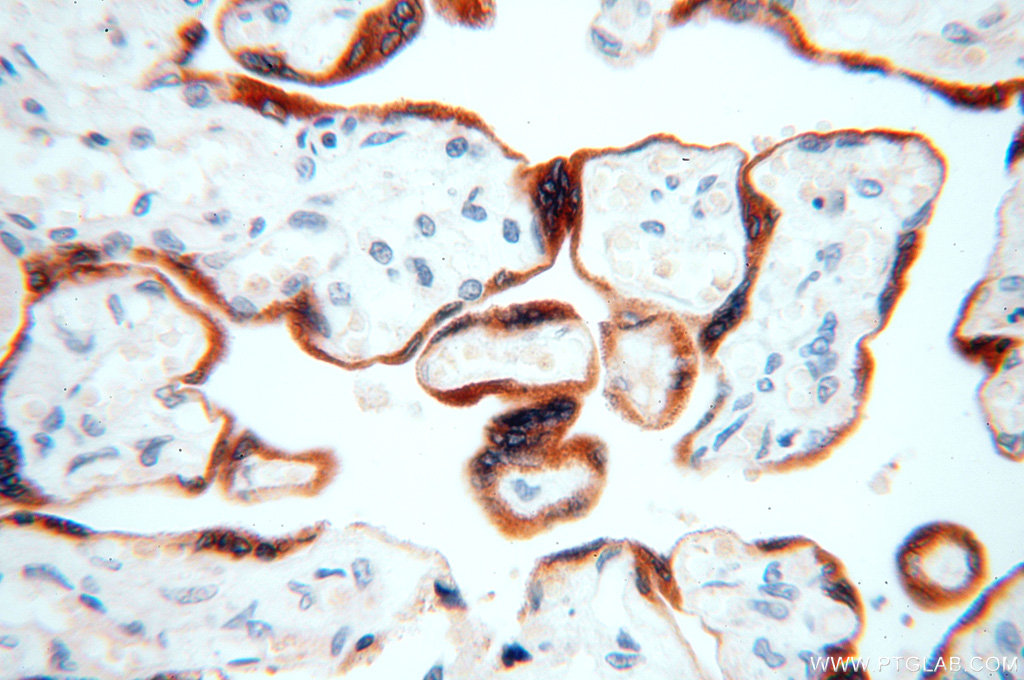 IHC staining of human placenta using 17870-1-AP