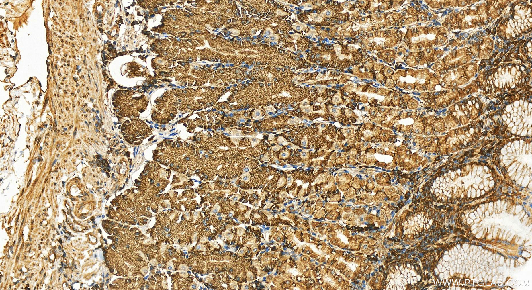 IHC staining of human stomach using 12034-1-AP