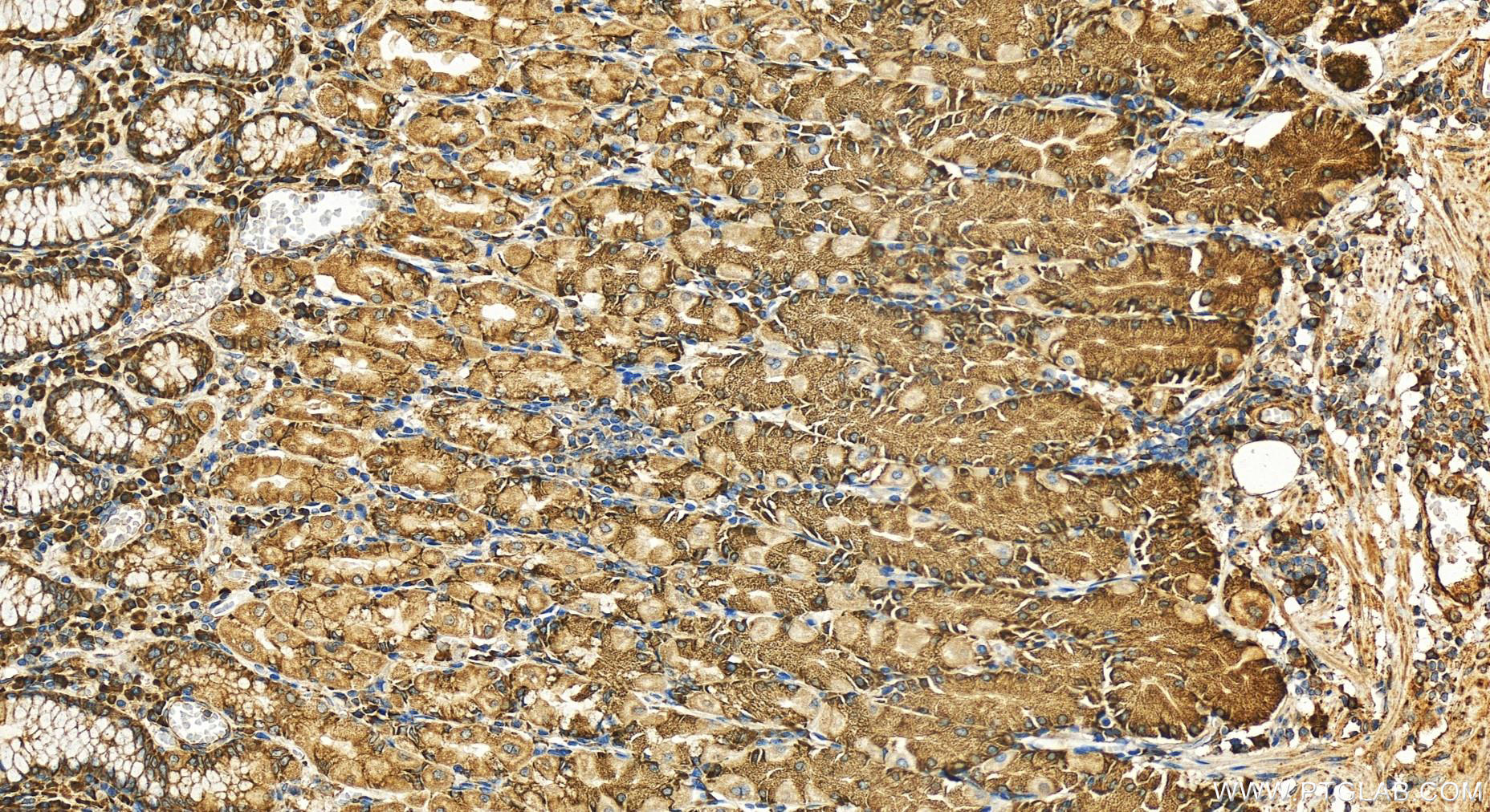 IHC staining of human stomach using 12034-1-AP