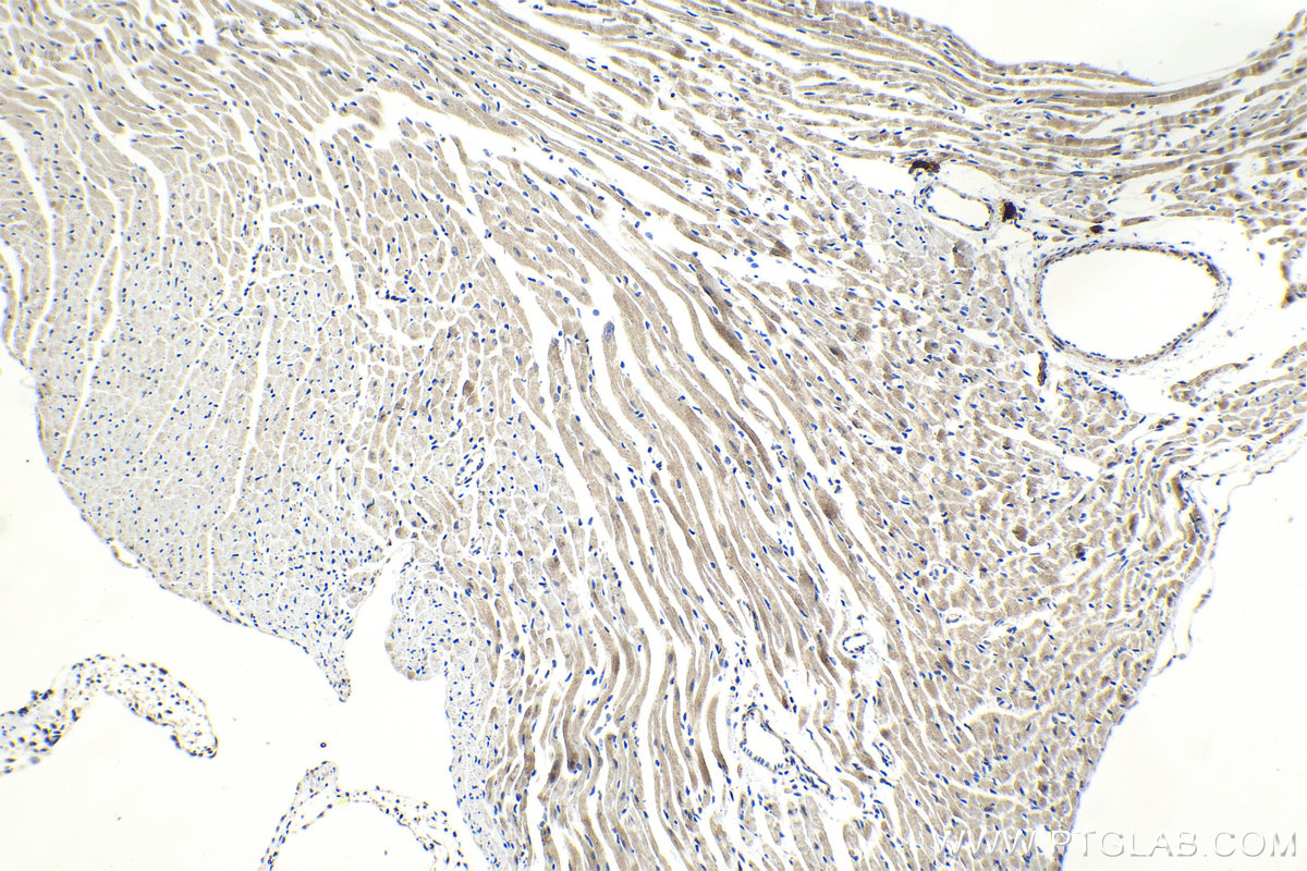 IHC staining of mouse heart using 11036-1-AP