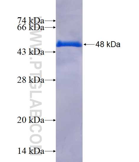 STX10 fusion protein Ag1501 SDS-PAGE