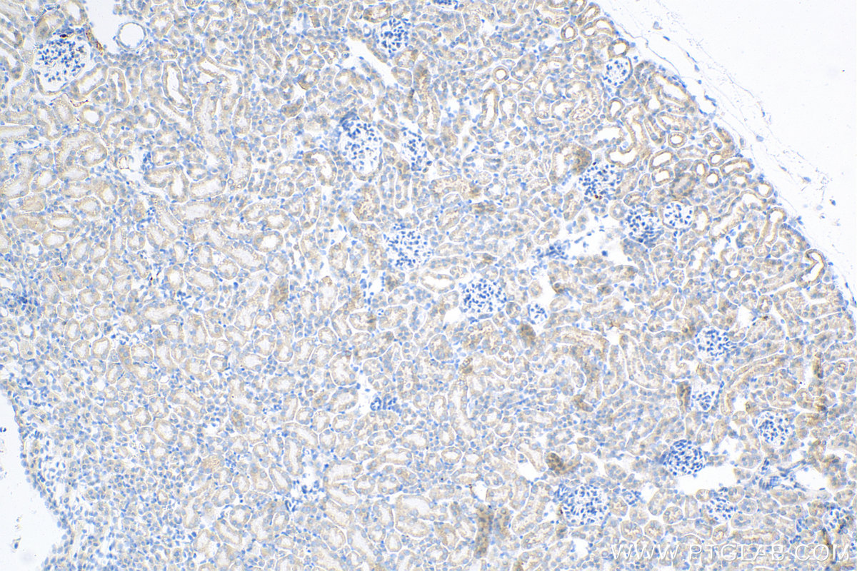 IHC staining of mouse kidney using 81899-1-RR (same clone as 81899-1-PBS)