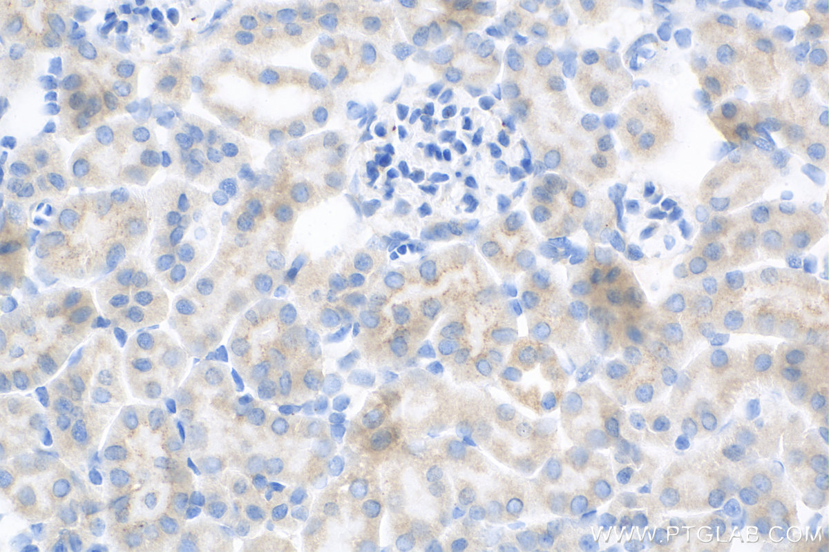 IHC staining of mouse kidney using 81899-1-RR