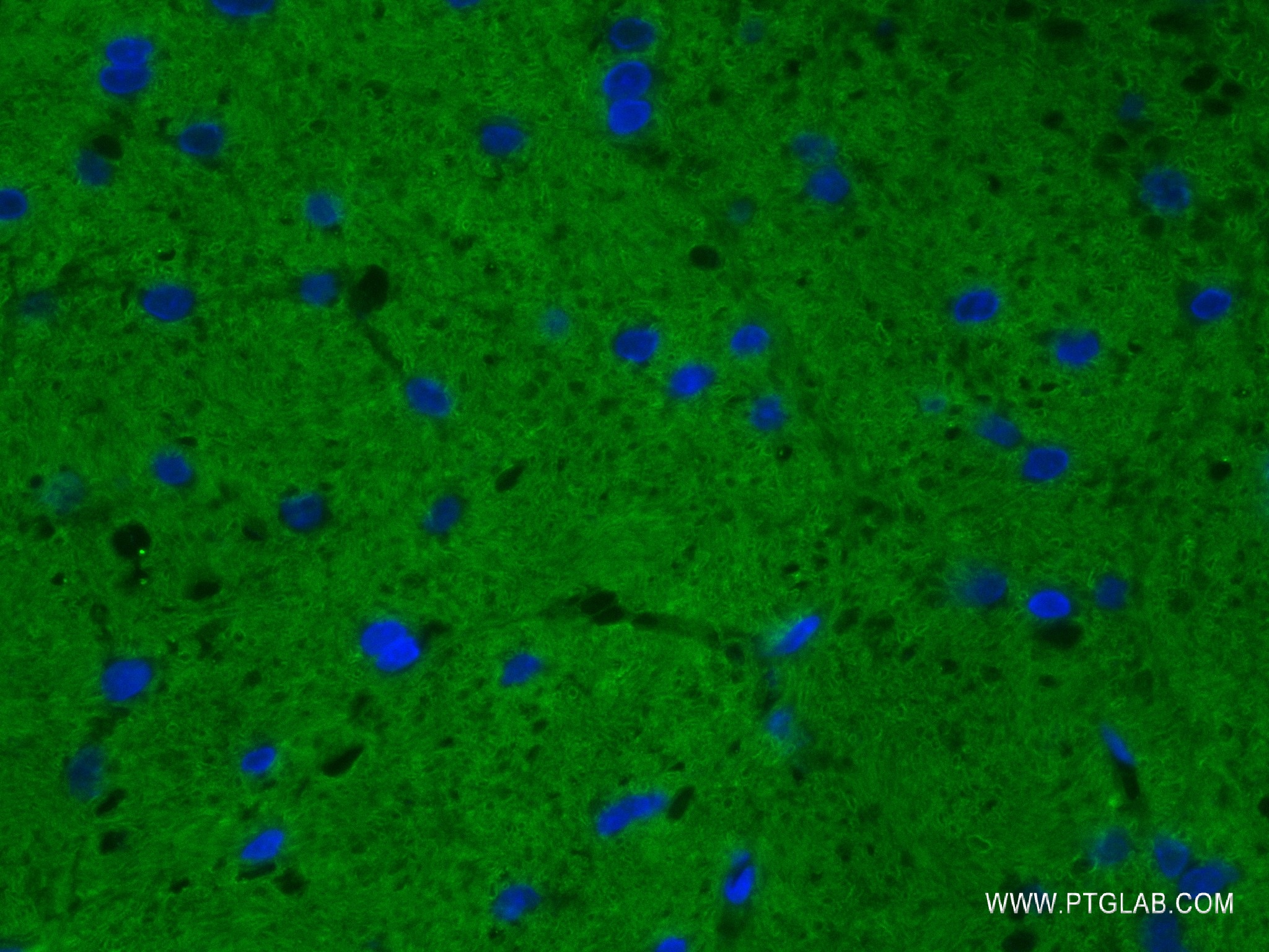 IF Staining of mouse cerebellum using 83159-6-RR (same clone as 83159-6-PBS)