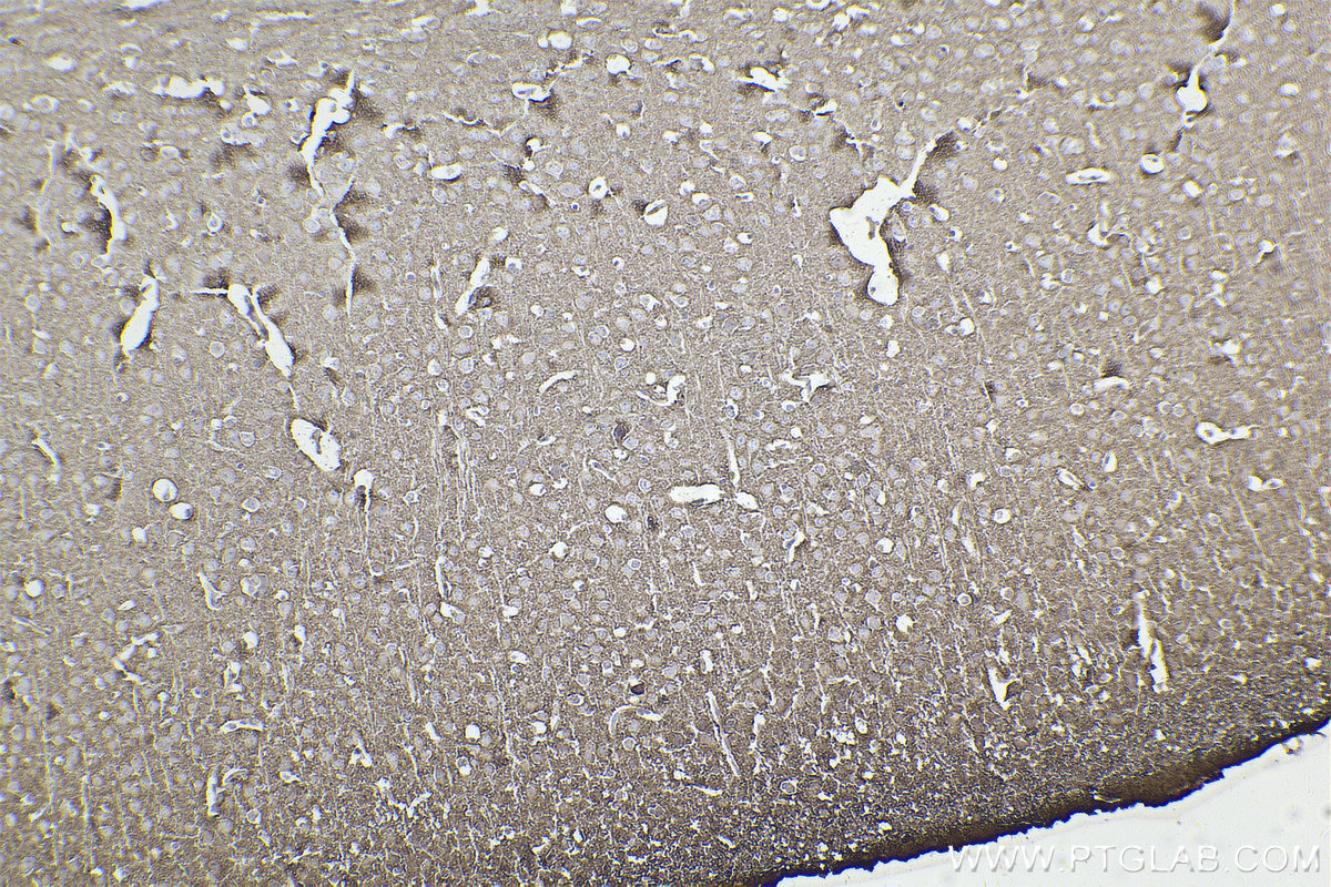 IHC staining of mouse brain using 83159-6-RR (same clone as 83159-6-PBS)