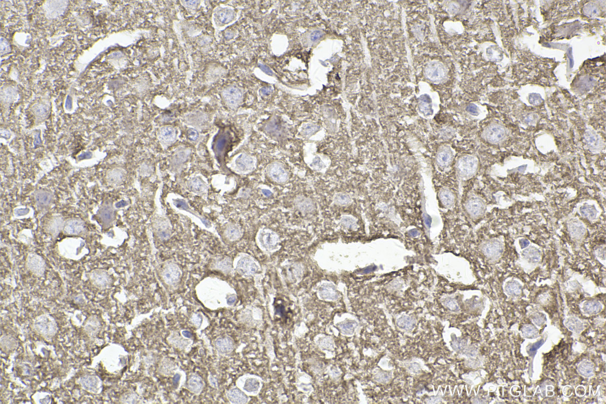 IHC staining of mouse brain using 83159-6-RR