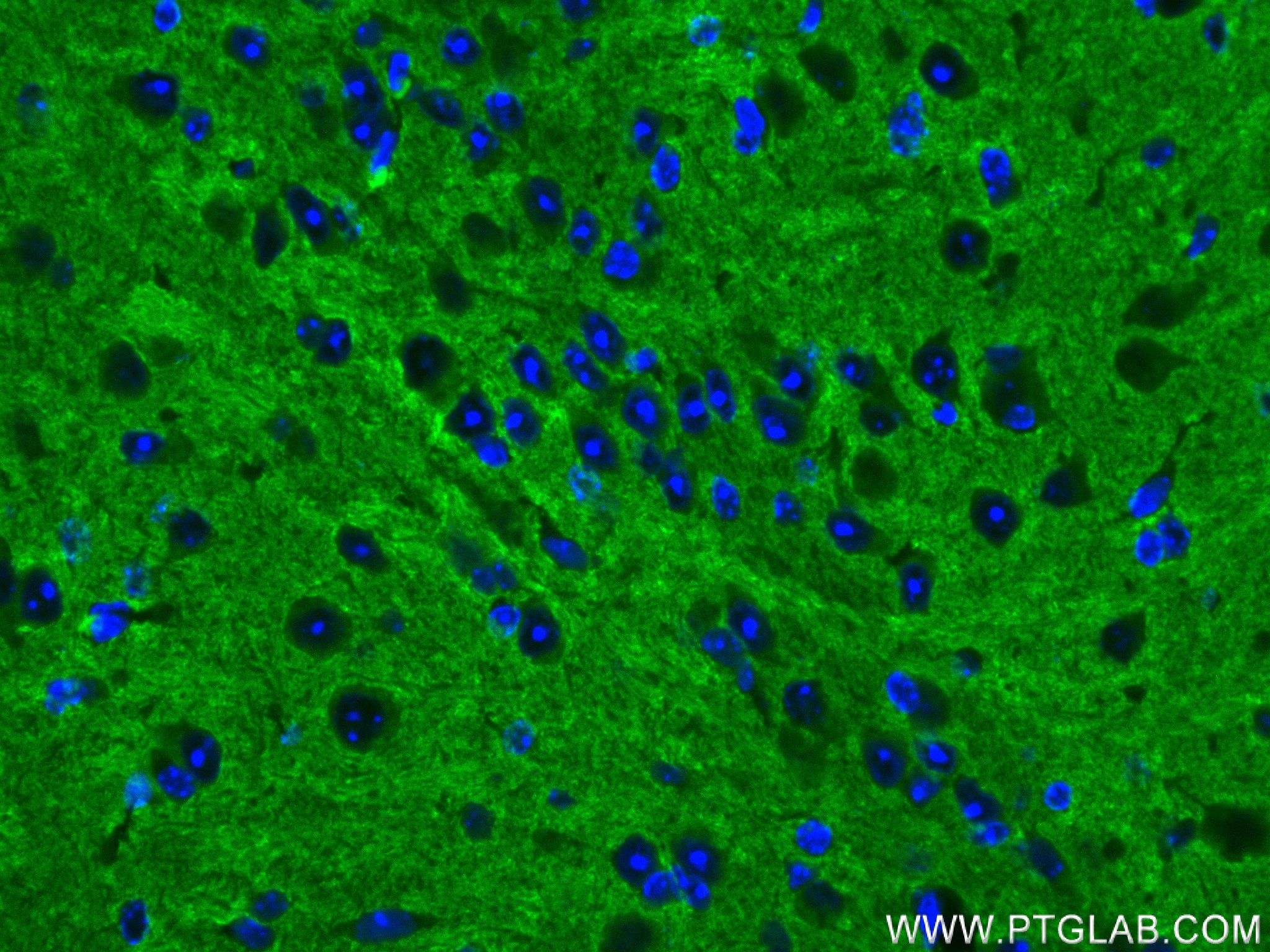 IF Staining of mouse brain using 83298-1-RR (same clone as 83298-1-PBS)