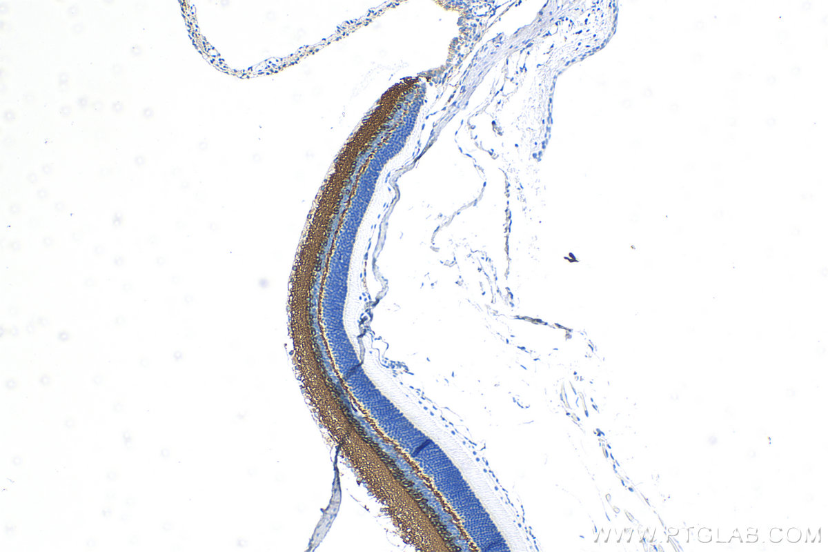 IHC staining of mouse eye using 83298-1-RR (same clone as 83298-1-PBS)