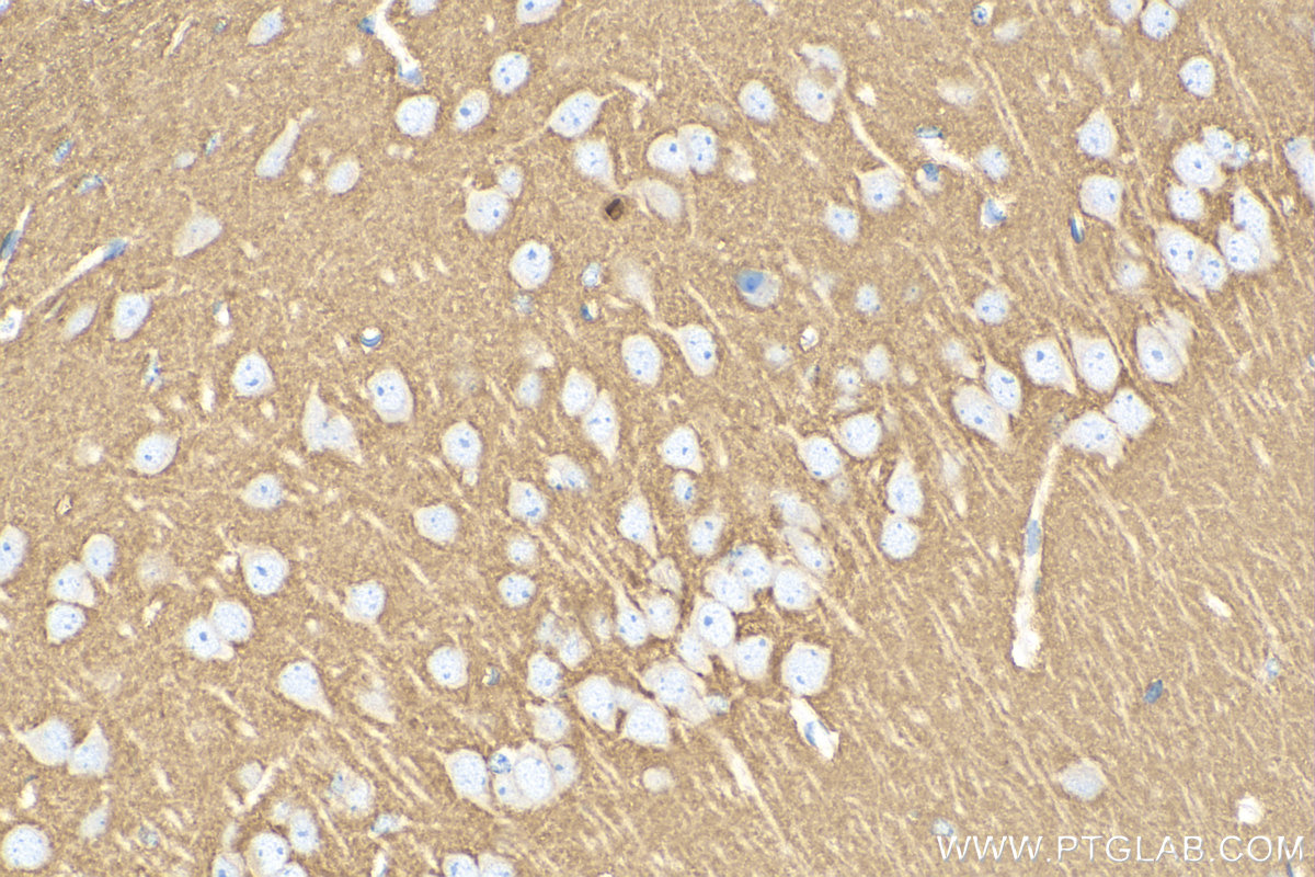 IHC staining of mouse brain using 83298-1-RR (same clone as 83298-1-PBS)