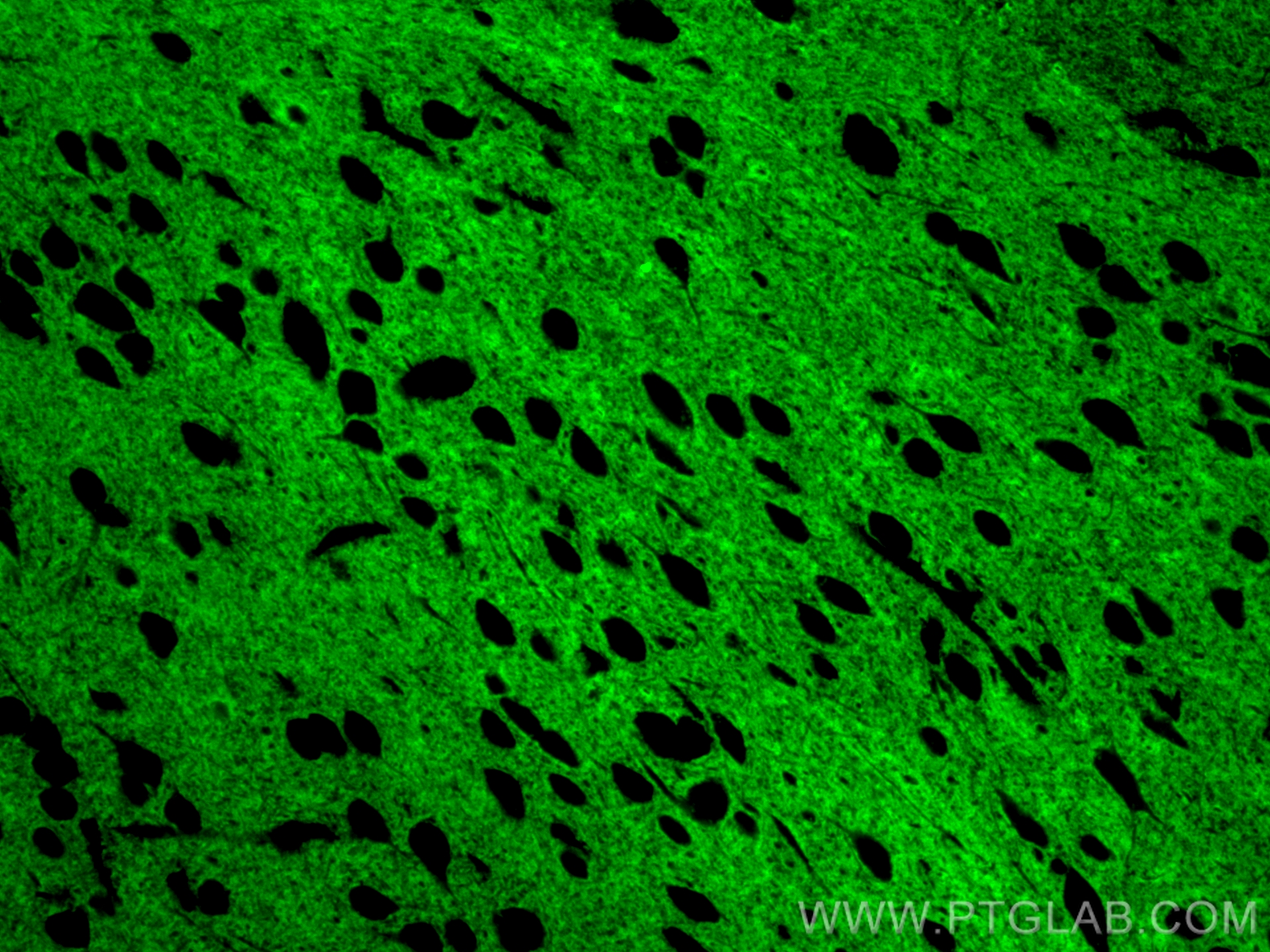 IF Staining of mouse brain using CL488-83298