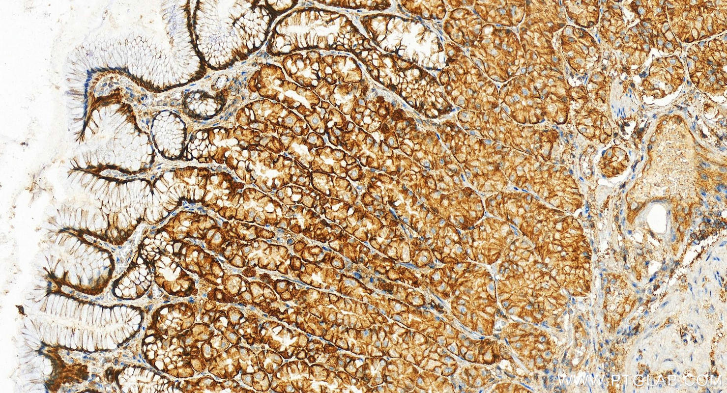 IHC staining of human stomach using 14988-1-AP