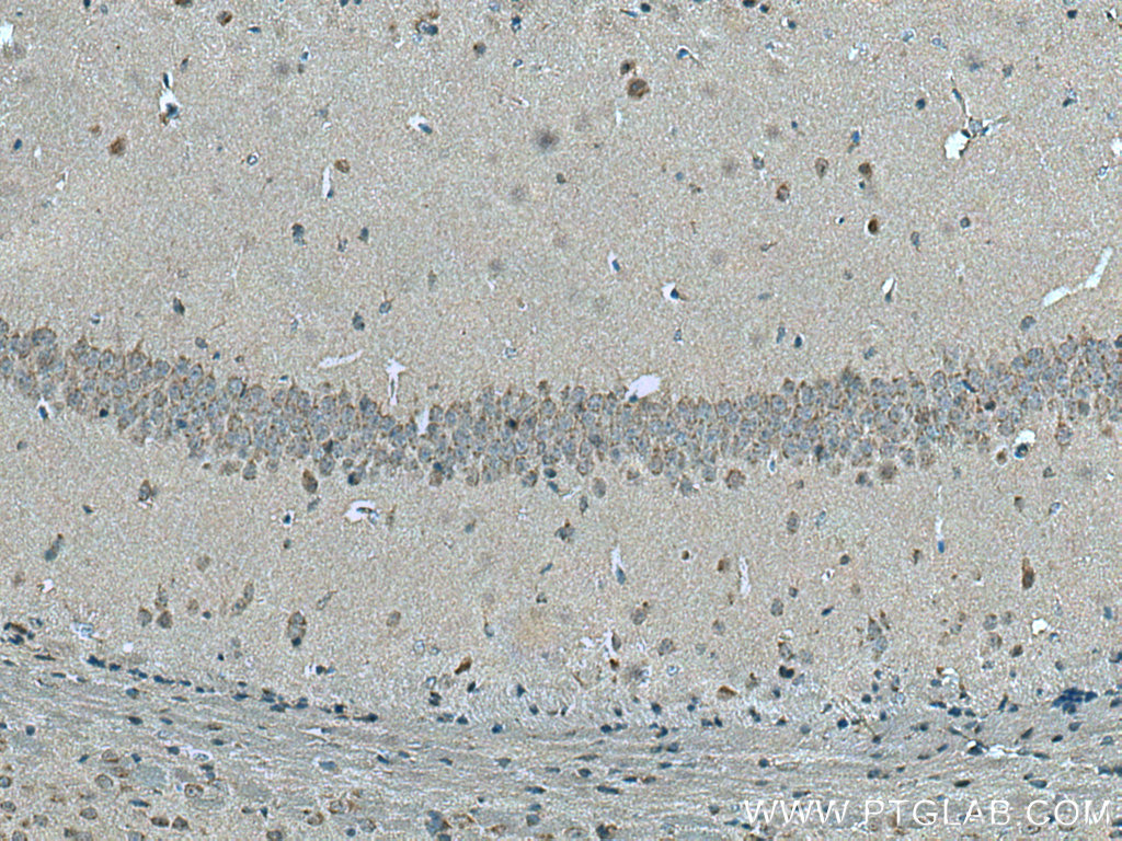 IHC staining of mouse brain using 26711-1-AP