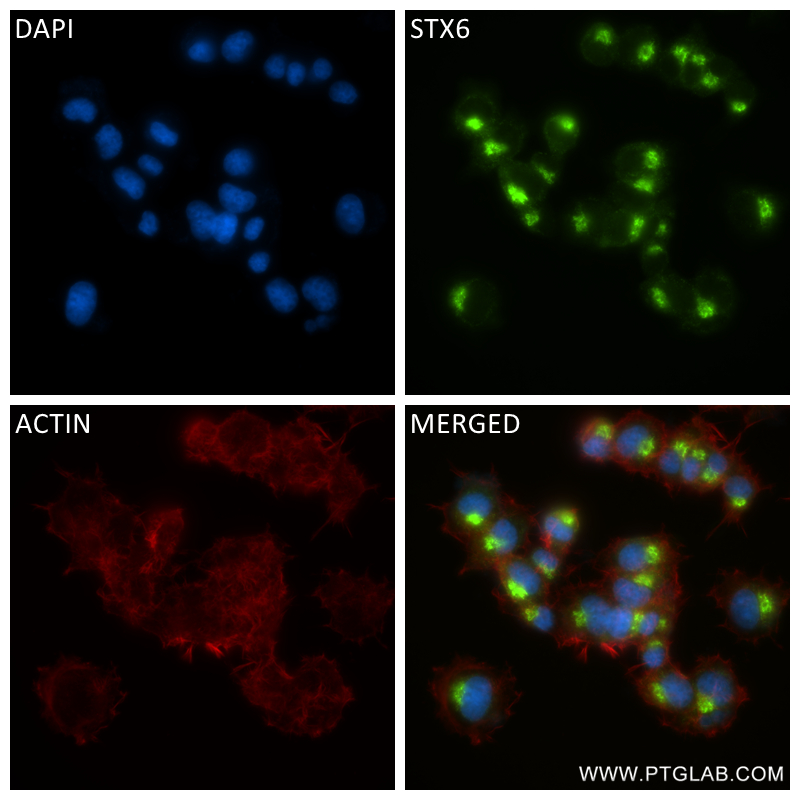 IF Staining of PC-12 using 84627-5-RR (same clone as 84627-5-PBS)