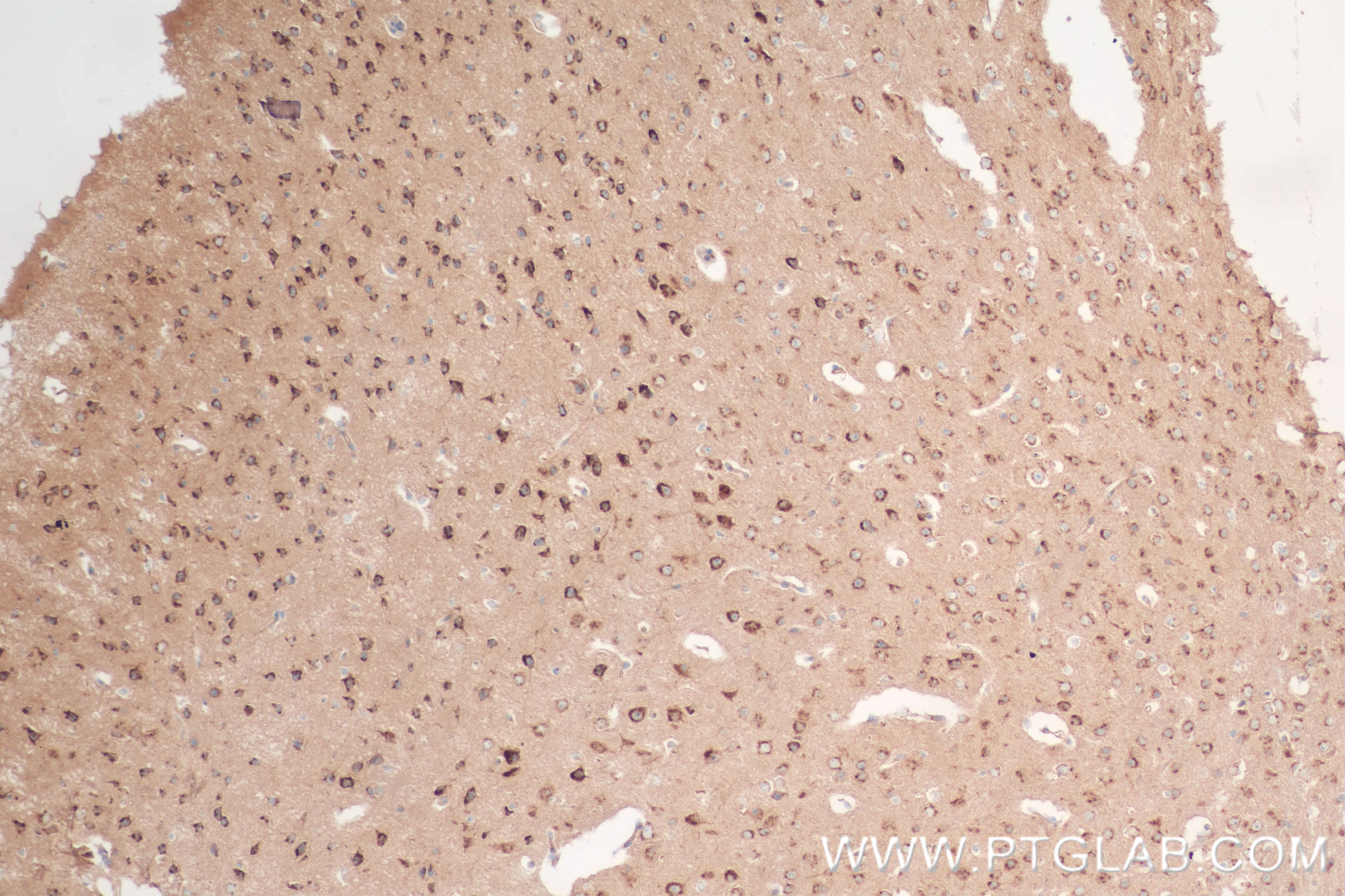 IHC staining of mouse brain using 84627-5-RR (same clone as 84627-5-PBS)