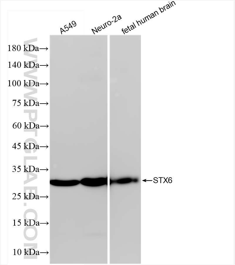 WB analysis using 84627-5-RR (same clone as 84627-5-PBS)