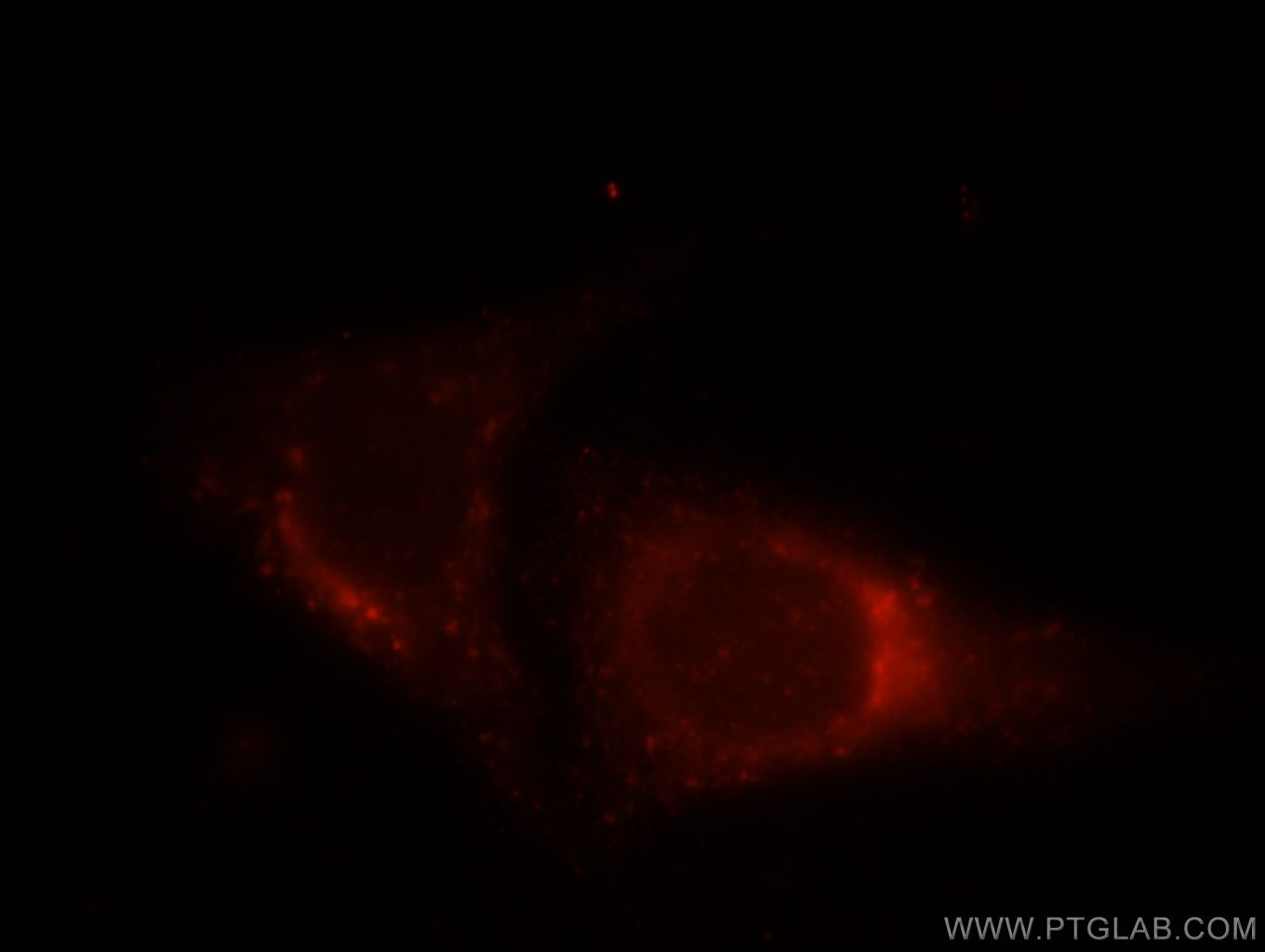 IF Staining of HepG2 using 12206-1-AP