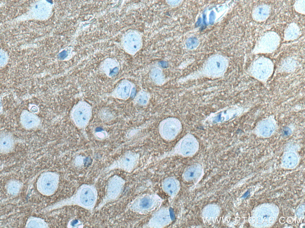 IHC staining of mouse brain using 67137-1-Ig (same clone as 67137-1-PBS)