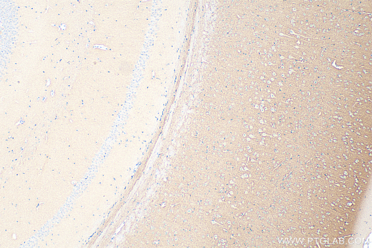 IHC staining of mouse brain using Biotin-67137