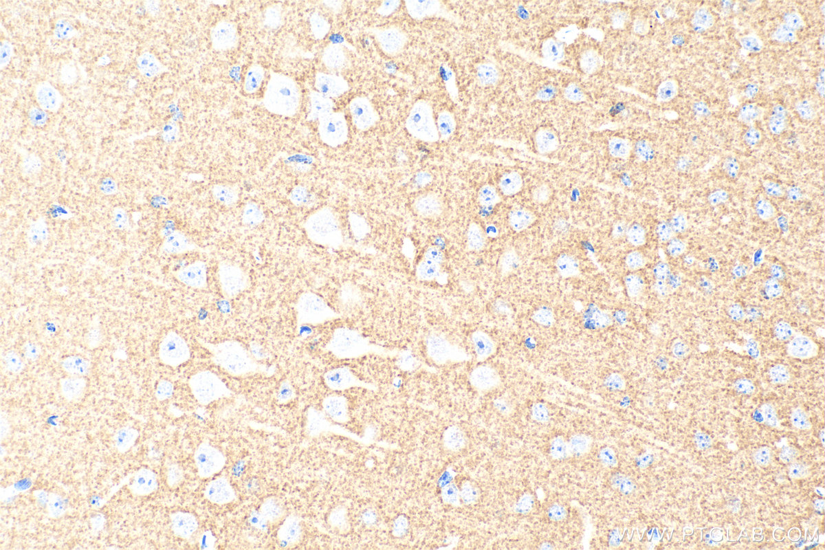 IHC staining of mouse brain using Biotin-67137