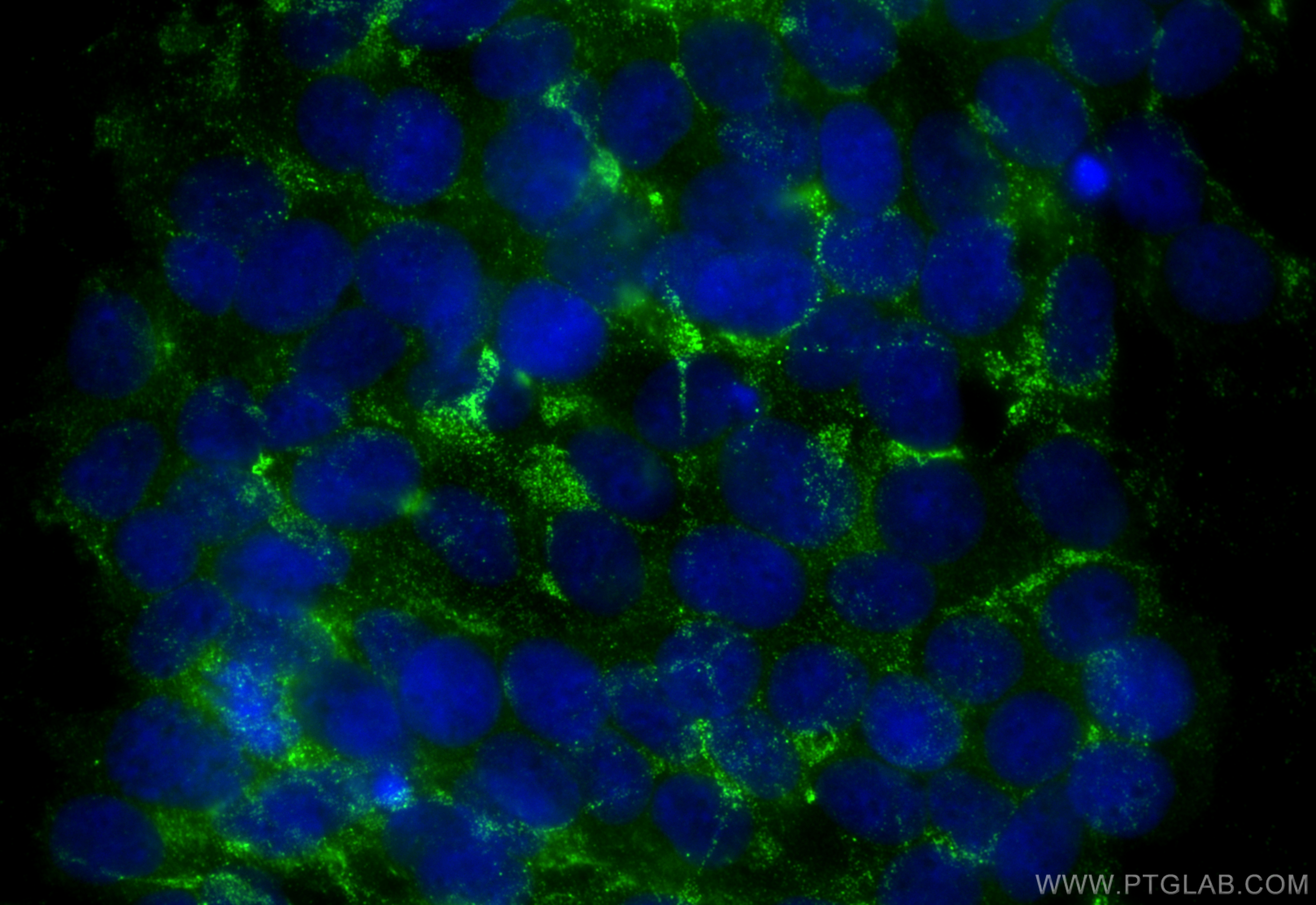 IF Staining of SH-SY5Y using 24512-1-AP