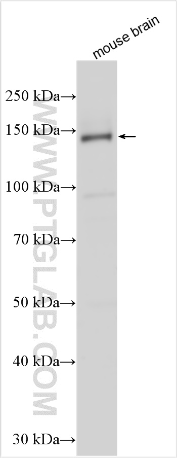 WB analysis using 24512-1-AP