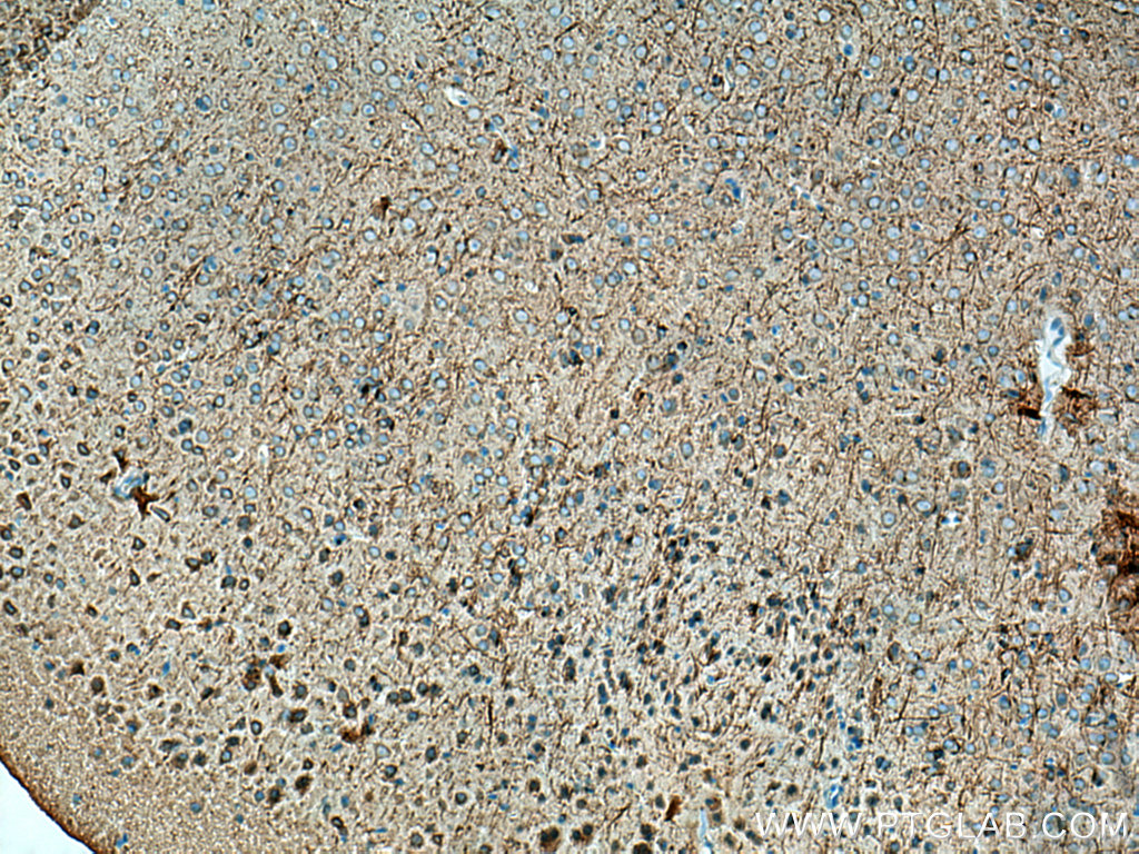 IHC staining of mouse brain using 18028-1-AP