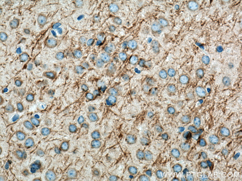 IHC staining of mouse brain using 18028-1-AP