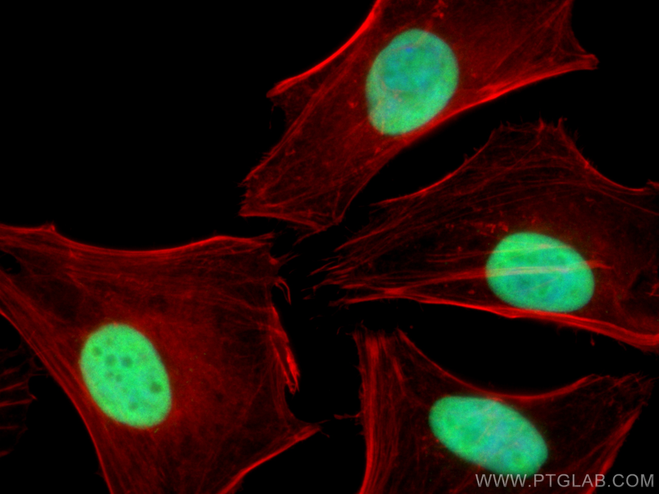 IF Staining of HeLa using 10948-2-AP