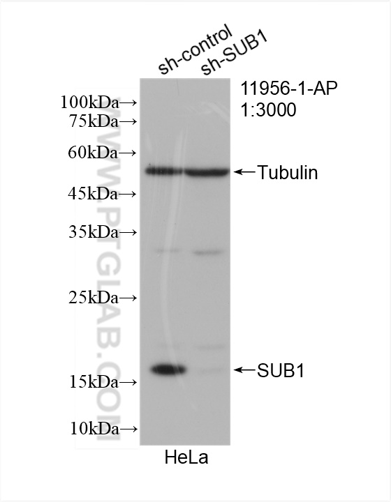 WB analysis of HeLa using 11956-1-AP