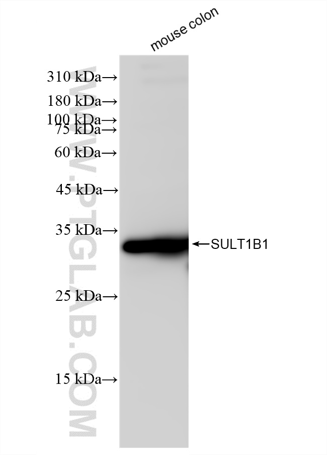 WB analysis of mouse colon using 83228-1-RR (same clone as 83228-1-PBS)