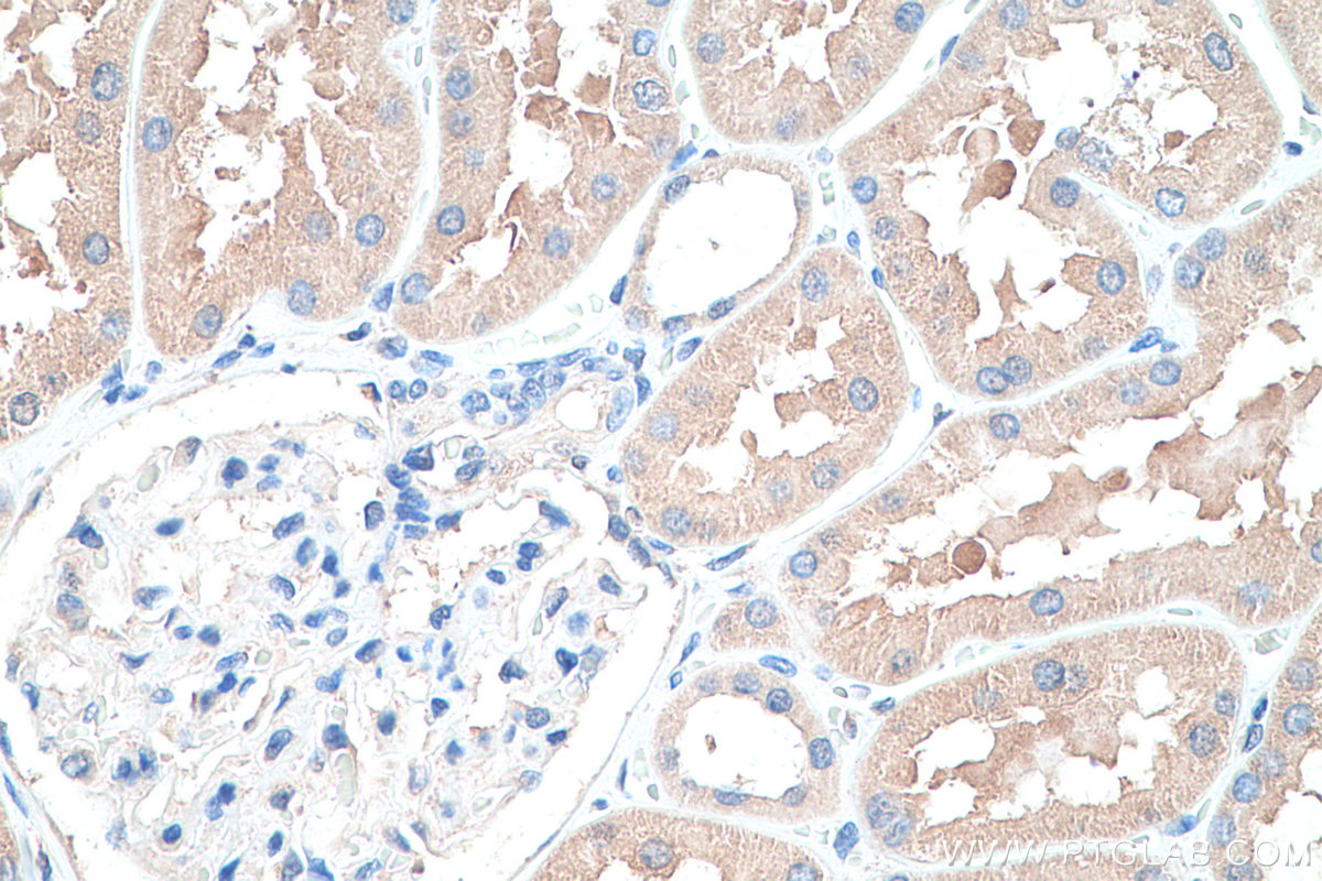 IHC staining of human kidney using 16348-1-AP