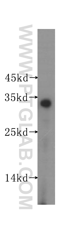 WB analysis of human adrenal gland using 16348-1-AP