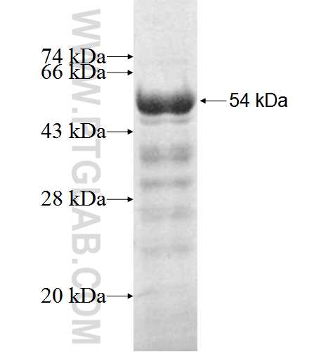 SULT2B1 fusion protein Ag3838 SDS-PAGE