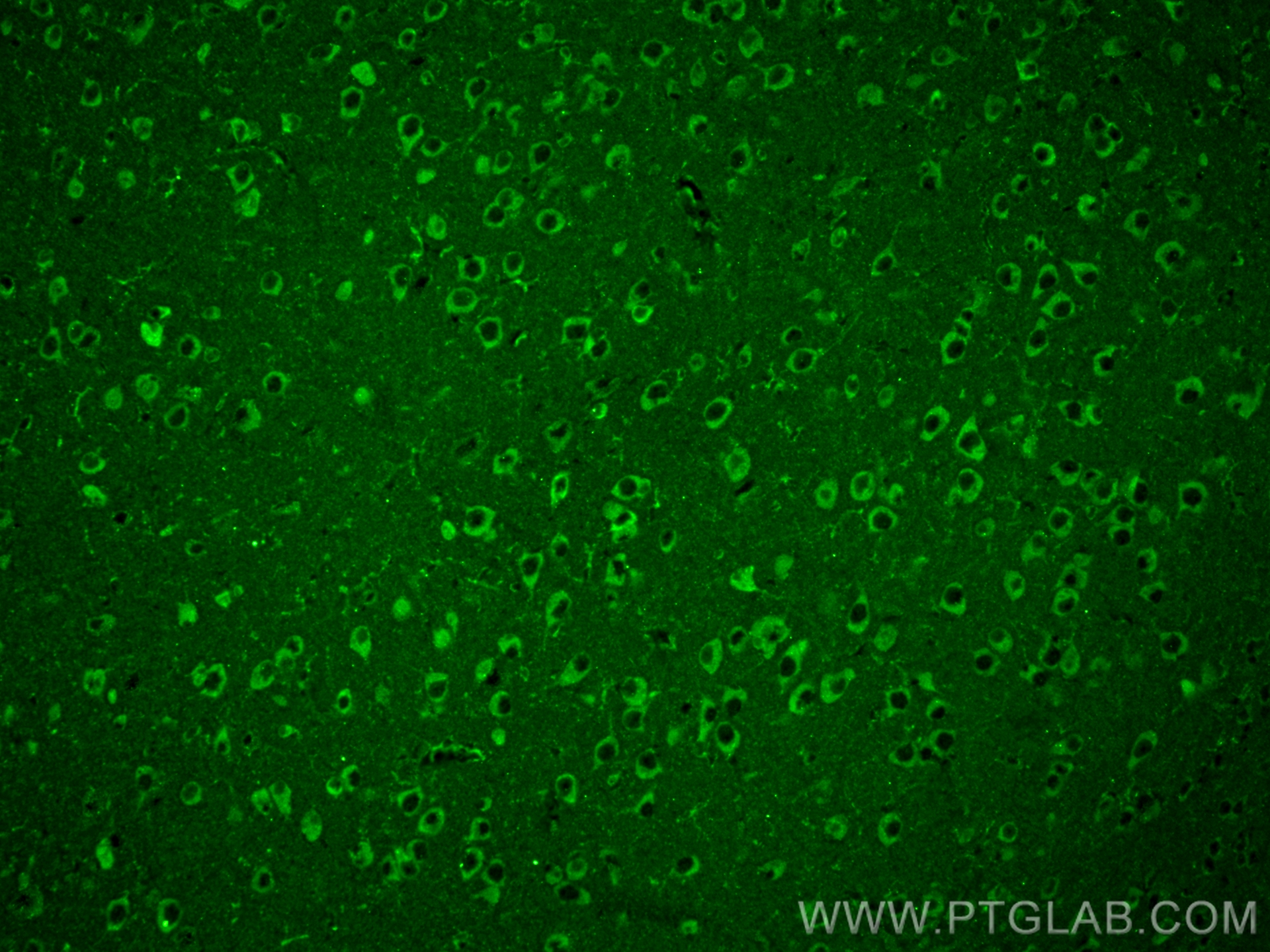 IF Staining of mouse brain using 66106-1-Ig (same clone as 66106-1-PBS)