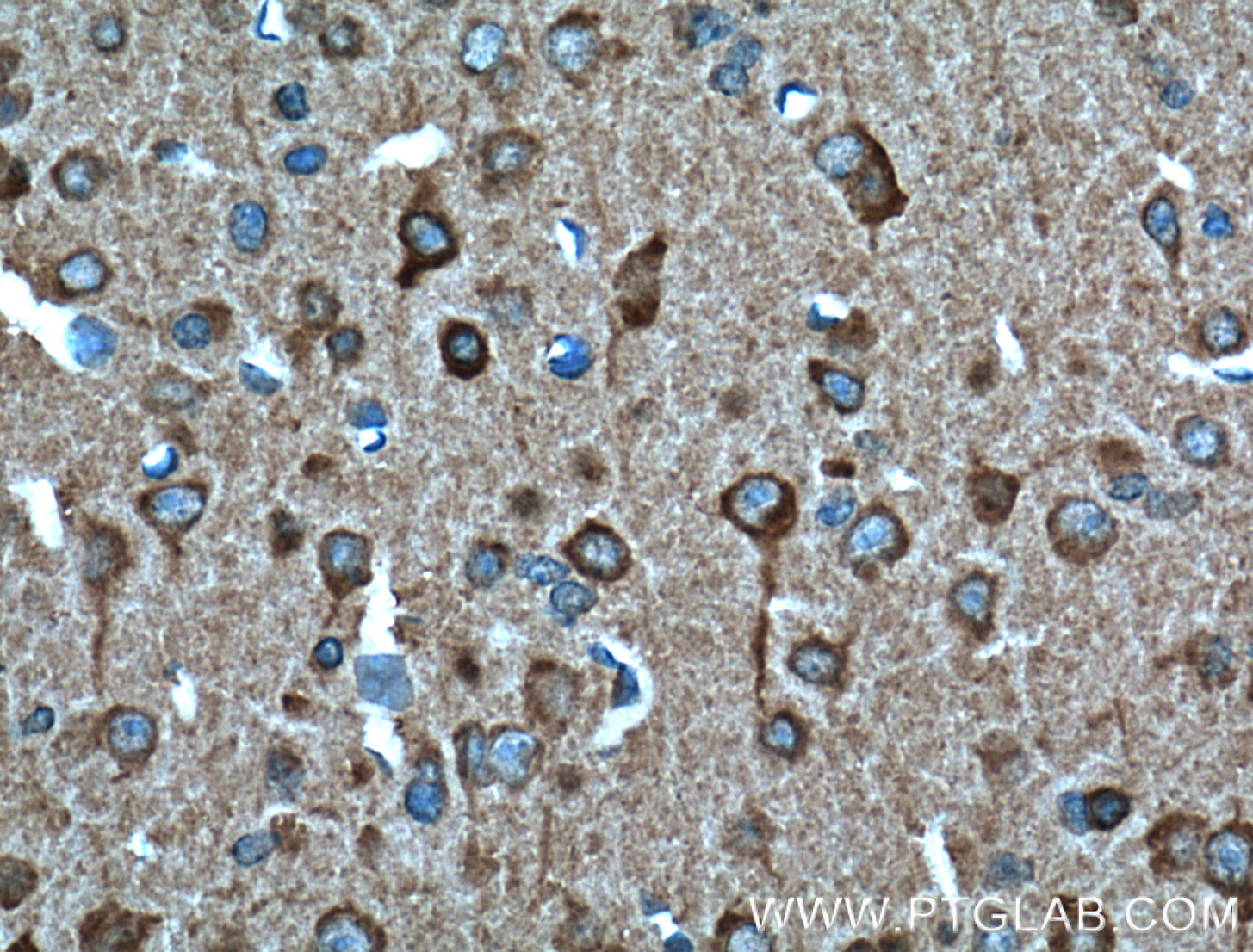 IHC staining of mouse brain using 66106-1-Ig (same clone as 66106-1-PBS)