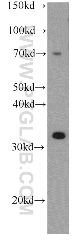 WB analysis of human brain using 66106-1-Ig (same clone as 66106-1-PBS)