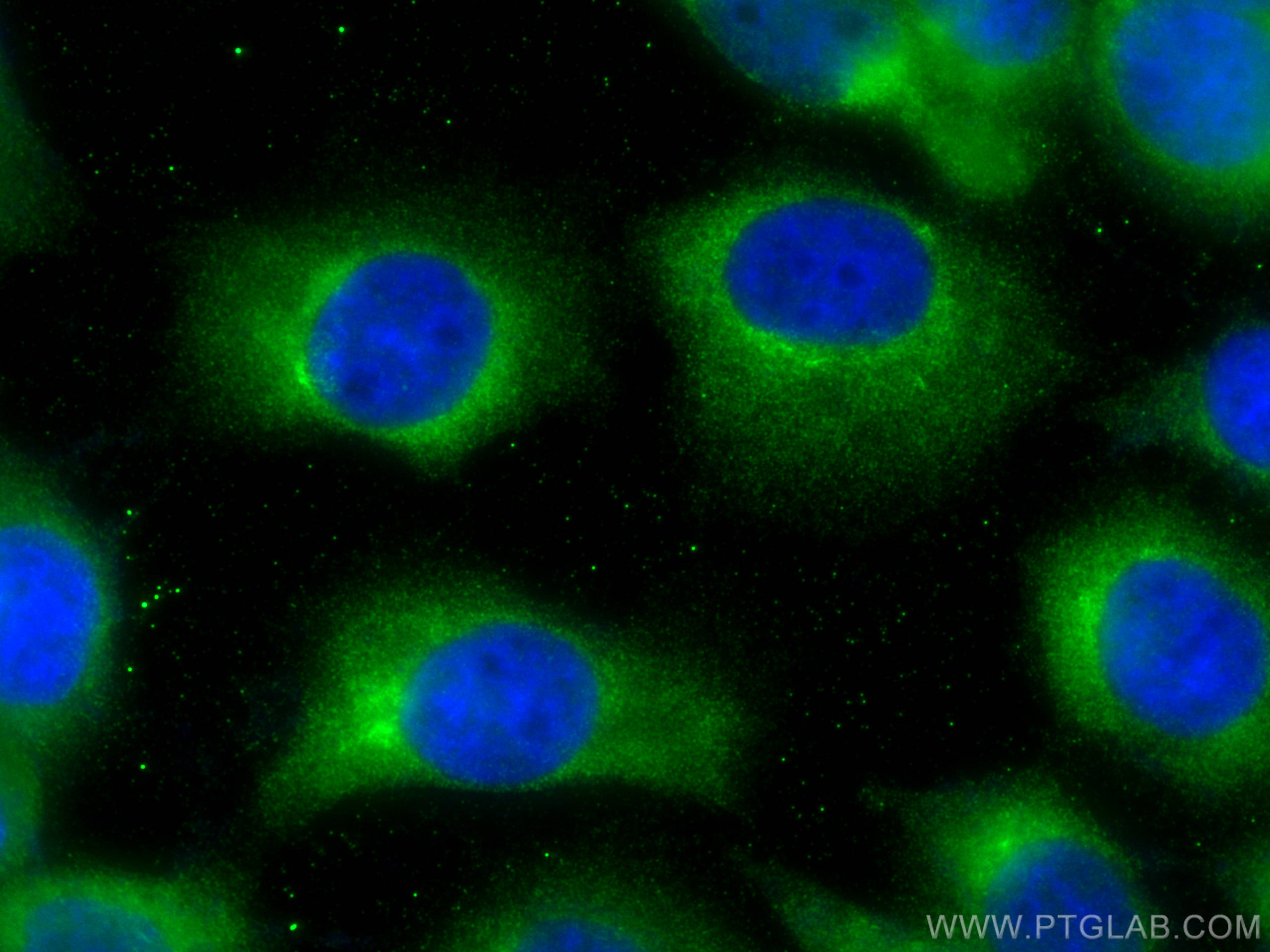 IF Staining of A431 using 11210-1-AP